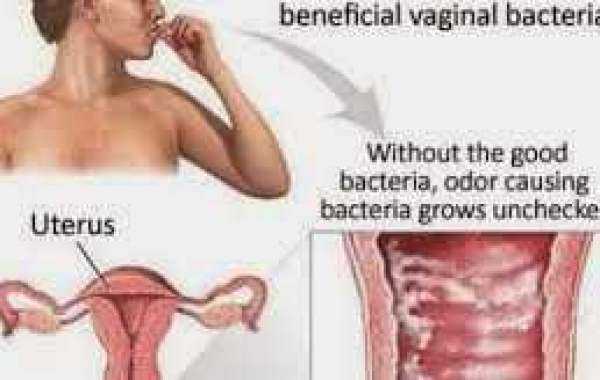 Особенности бактериального вагиноза у женщин