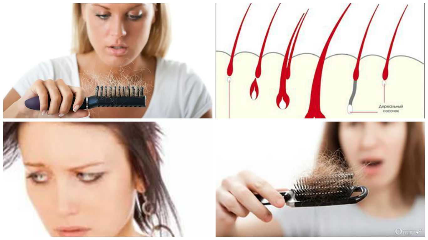 Как лечить ресницы при выпадении волос