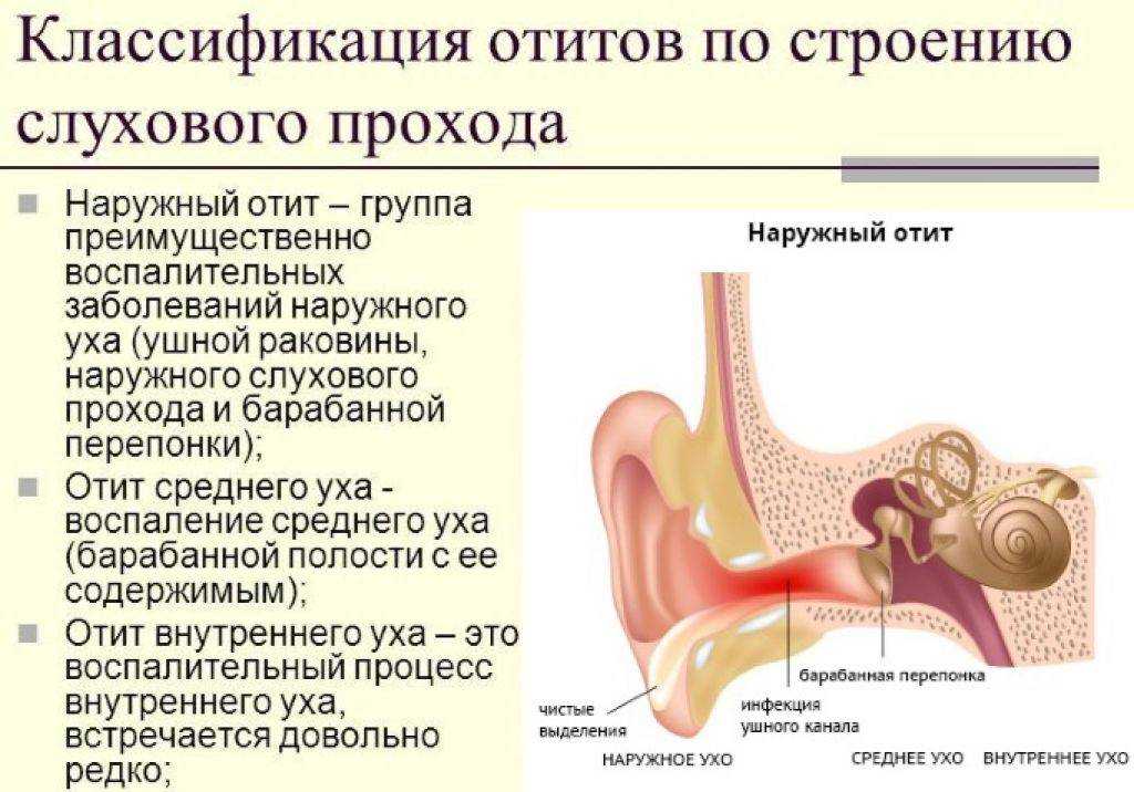 Осложнение слуха. Острый наружный средний отит. Наружный отит воспаление. Заболевания наружного уха отит наружный. Средний и наружный отит симптомы.