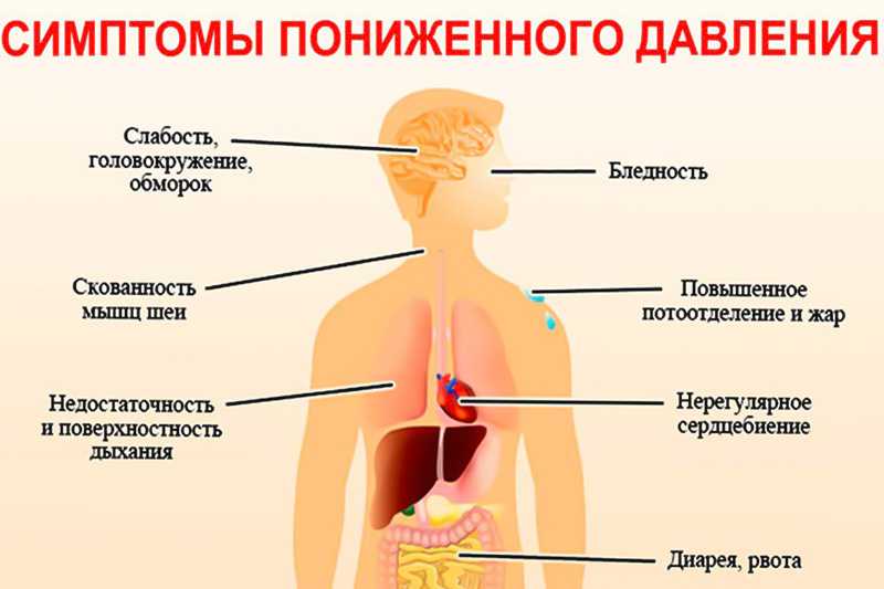 Люди гипотоники: кто это, с каким давлением живут, рекомендации по образу жизни