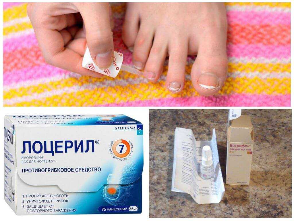 Онихолизис на ногах лечение препараты. Средство от грибка ногтей. Лекарство от грибка ногтей. Капли от грибка ногтей. Противогрибковое средство для ногтей на ногах.