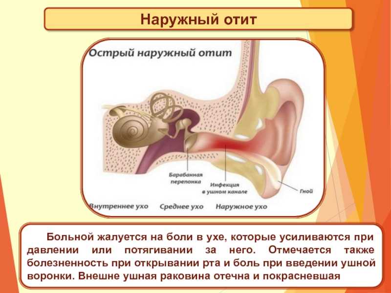Причины воспаления среднего уха. Слуховой анализатор отит. Острый диффузный отит клиника. Острый наружный разлитой отит.